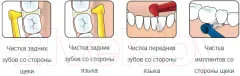 Ершики межзубные TePe Angle №5 для чистки брекетов и имплантов на длинной ручке (6шт) — фото 2