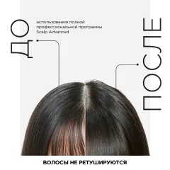 Кондиционер для волос L'Oreal Professionnel Scalp Advanced (200мл) — фото 6