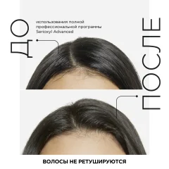 Сыворотка для волос L'Oreal Professionnel Serioxyl Density (90мл) — фото 6